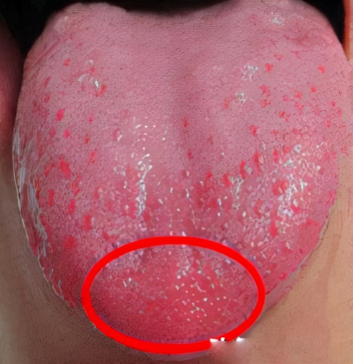 下半身怕冷怕风是什么原因,下半身特别怕冷不敢吹空调