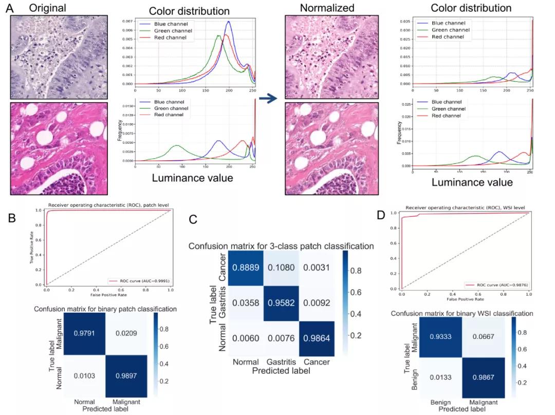 于颖彦教授：利用深度学习模型预测胃黏膜良恶性病变新进展