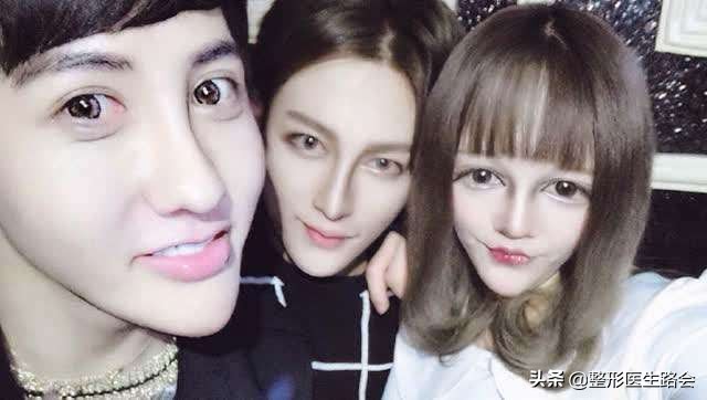 为什么侧颜没有下巴轮廓,侧颜怎么p下巴