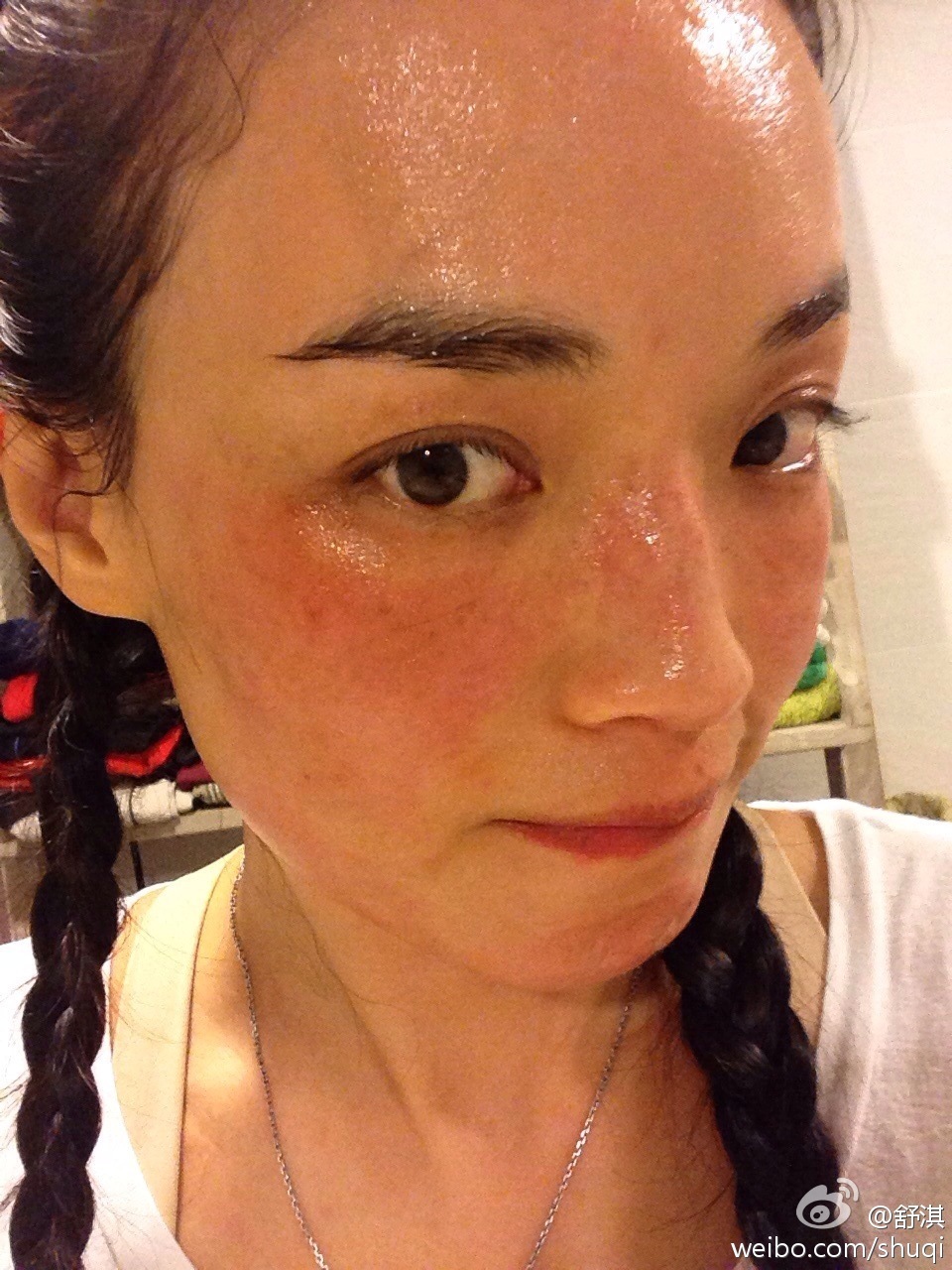 换季皮肤干燥发痒怎么护肤,干痒脱皮刺痛泛红如何拯救敏感肌