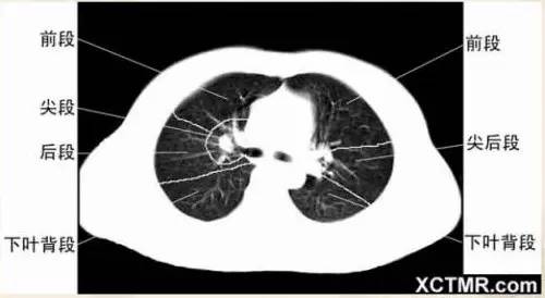 女性盆腔ct断层解剖结构图,女性盆腔脏器ct解剖