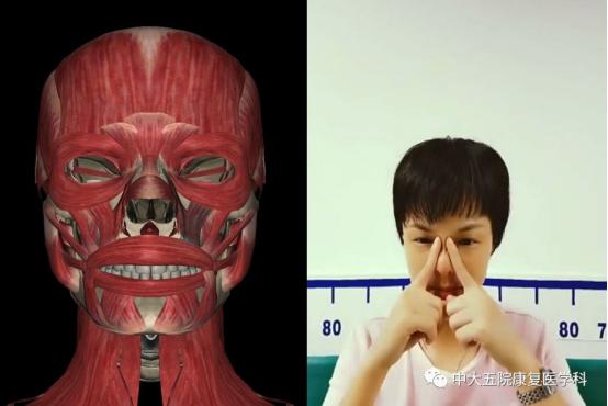 面瘫临床表现的科普视频,科普面瘫多久治疗效果最好