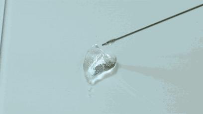 玻尿酸的效果,玻尿酸的美容优势有哪些