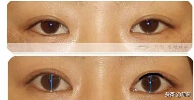 辛芷蕾是苦相女生吗,辛芷蕾气质怎么养成