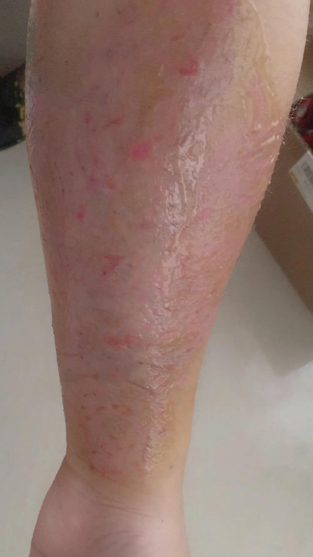 洗纹身到底能不能洗干净,洗纹身能不能彻底洗干净