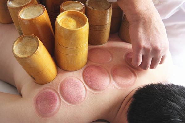 拔火罐后，为什么皮肤上会有黑紫印？