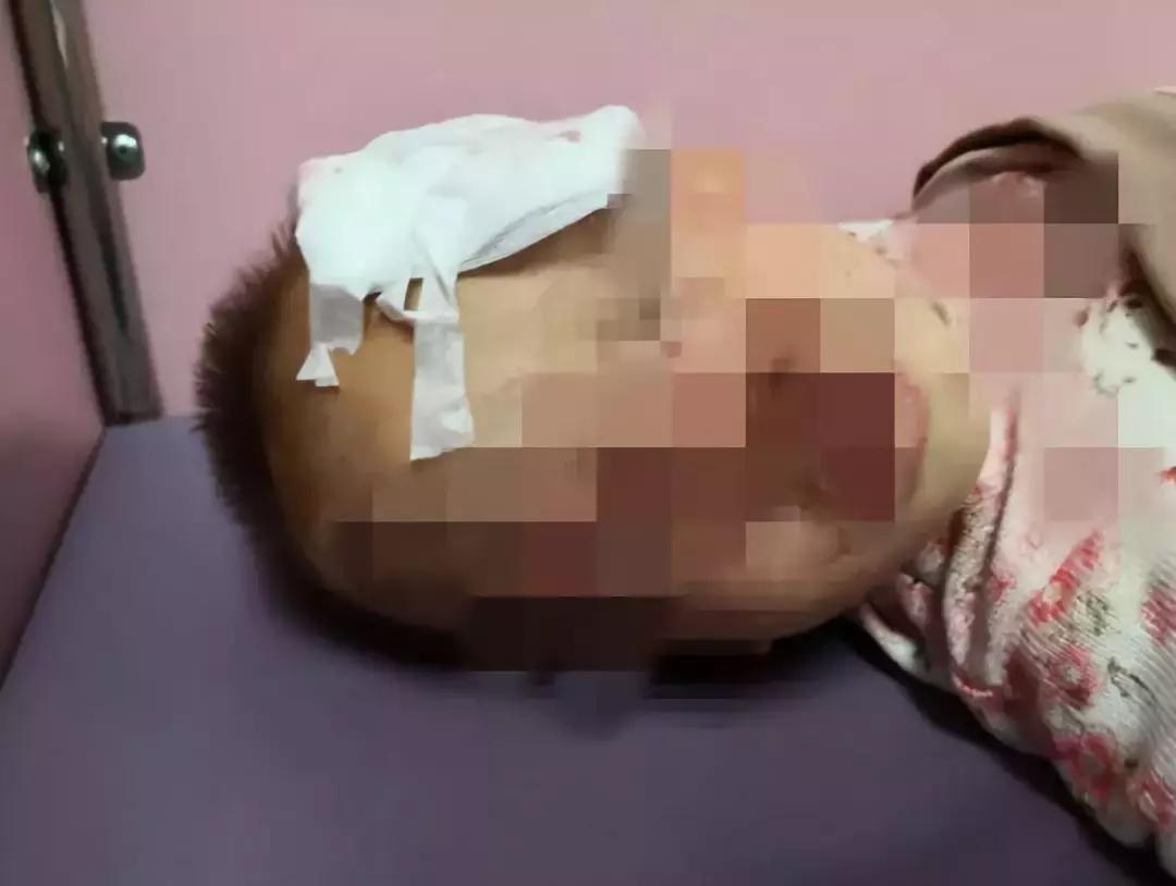 遛狗不牵绳算野狗吗,遛狗不牵狗绳咬伤别人怎么办