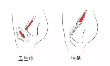 女生第一款卫生棉条 (适合女孩用的卫生棉条)