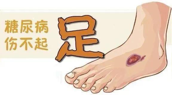 糖尿病下肢溃疡用什么药,糖尿病引起的下肢疼痛有什么危险