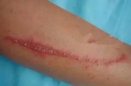 端午节怎么避毒,端午节需要注意的事项