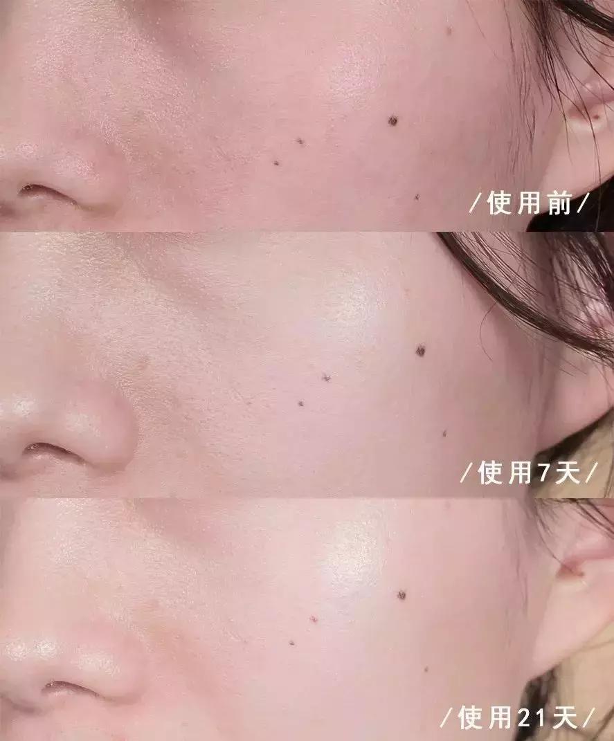 韩国小灯泡美白精华怎么样,韩国小灯泡精华抗皱效果