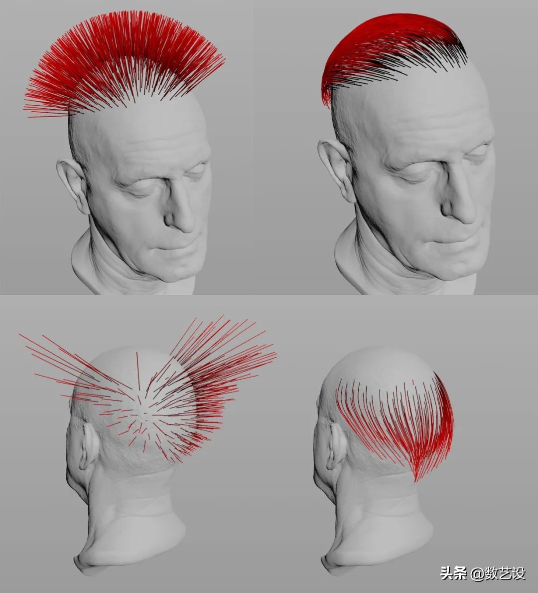 脱发过程3d动画,脱发有救了