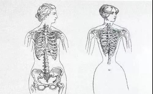 “内脏下垂、子宫脱落、漏尿……”:扒一扒你不知道的网红束腰