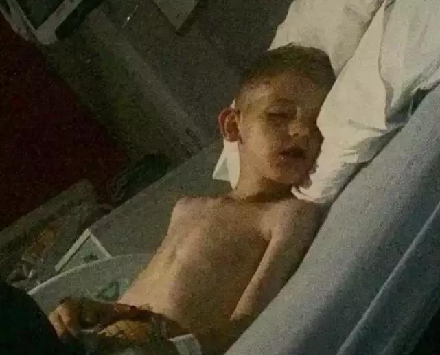 孩子舌头被饮料瓶困住,小孩喝水舌头被卡杯盖