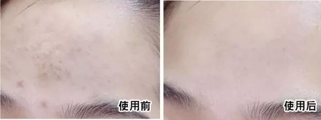 虾青素推荐新西兰,平价虾青素抗老精华