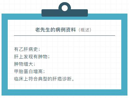 肝癌科普,科普解读肝癌介入