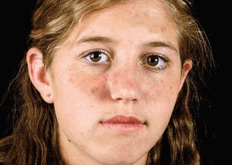 去晒斑护肤推荐,日晒斑用什么护肤品最好