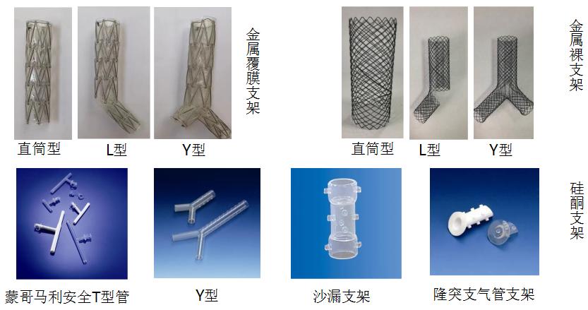 孙加源门诊,治疗肺癌的新技术新手段