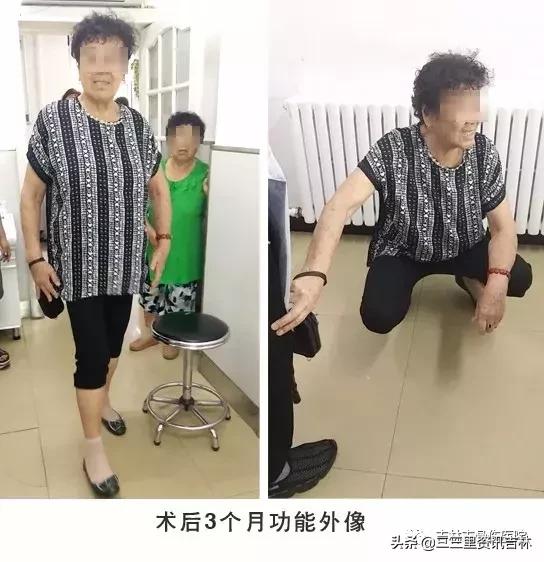 从医30余年，他治疗数以万计骨伤骨病患者