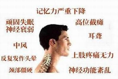 怎样预防颈椎病引起的头晕,得了脊髓型颈椎病怎么预防