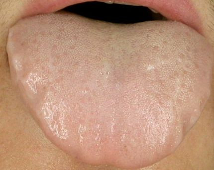 归脾丸是阳虚还是阴虚,归脾丸是养肝还是伤肝