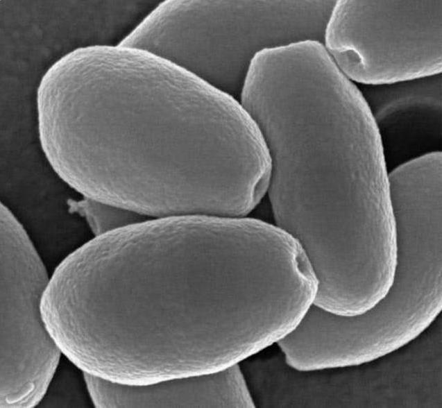 病毒巨型病毒,病毒出现超级变异