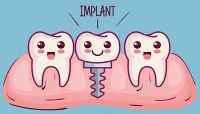 口腔种植专家为您解析,口腔种植牙科普