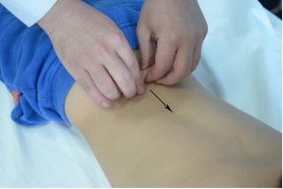 济宁推拿小儿斜颈,医院小儿推拿夜间门诊