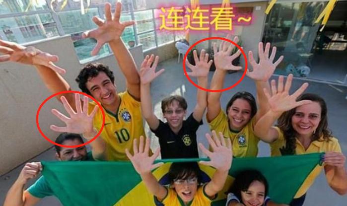 巴西六指家族再迎小生命,巴西六指家族