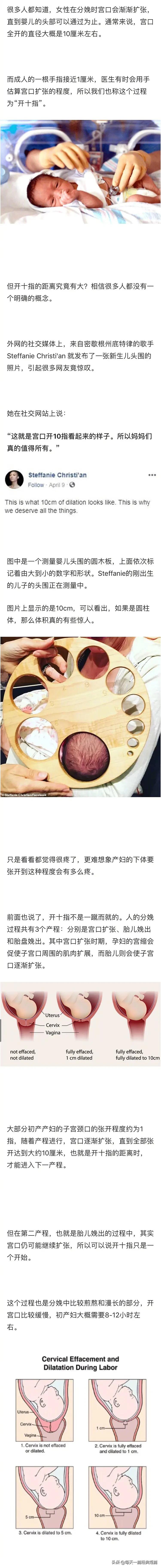 女人生孩子开几指,怀孕7个月宫口开多大属于正常