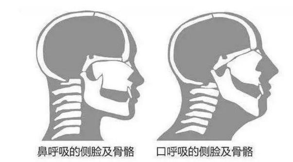 舍友打呼用音响,舍友打呼很大声我要怎么入睡