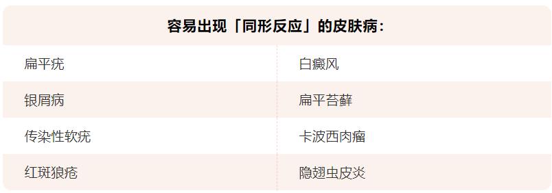 皮肤瘙痒口服什么止痒药,皮肤瘙痒怎么办快速止痒小妙招