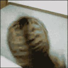 宝宝冬季头皮干燥头屑多怎么办,为什么头屑多了会导致头皮瘙痒