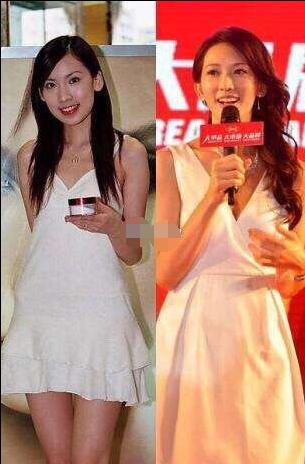 泫雅锁骨埋钉,泫雅晒打锁骨钉