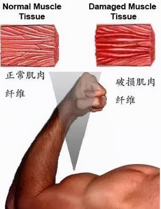 健身肌肉酸痛还能继续锻炼吗,健身缓解肌肉酸痛该吃什么补剂