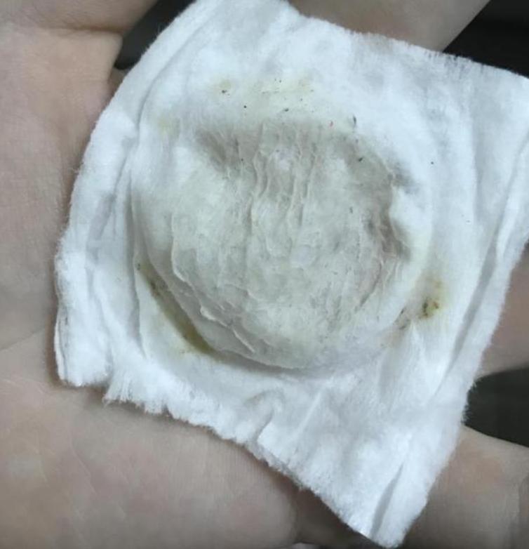 明星都是用什么牌子的美容仪,半个娱乐圈都用美容仪吗