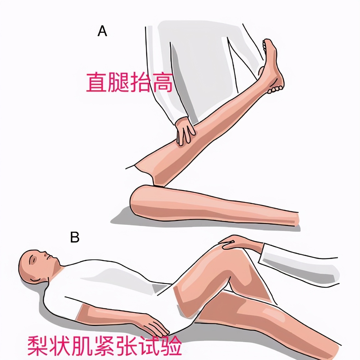 单边屁股疼站着明显缓解是什么病,单侧屁股疼要警惕四种原因