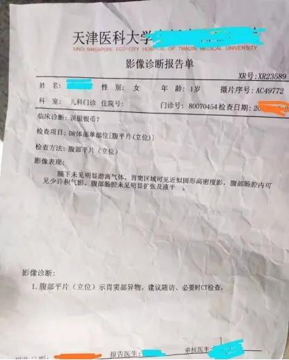 儿童误吞异物的正确方法,孩子不小心吞入异物卡住了怎么办