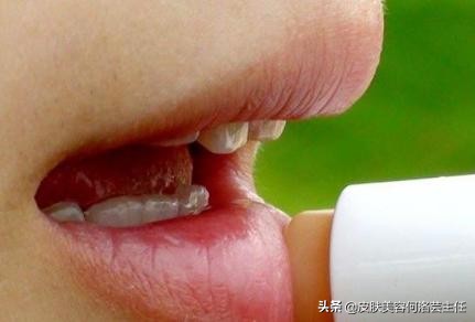 唇部干裂护理方法,嘴唇干裂起皮护唇推荐