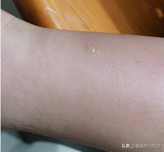 如果遇到红火蚁应该如何自救,红火蚁入侵要小心专家帮你划重点