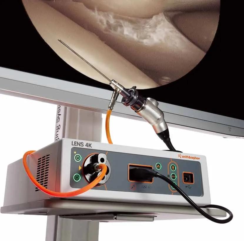 关节镜微创技术对关节炎有用吗,关节镜治疗过程