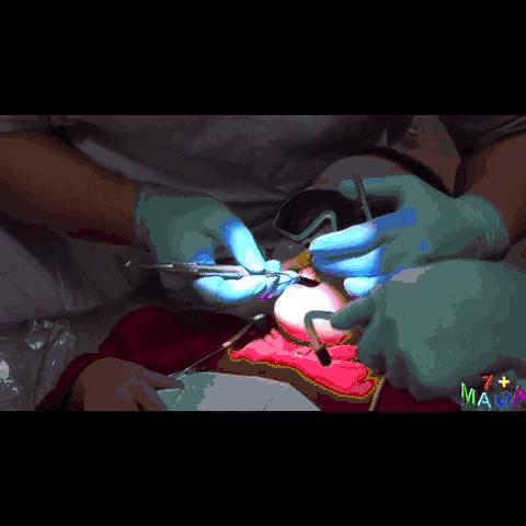 一般的刷牙方法能清除牙菌斑,小朋友牙齿有牙菌斑要洗掉吗