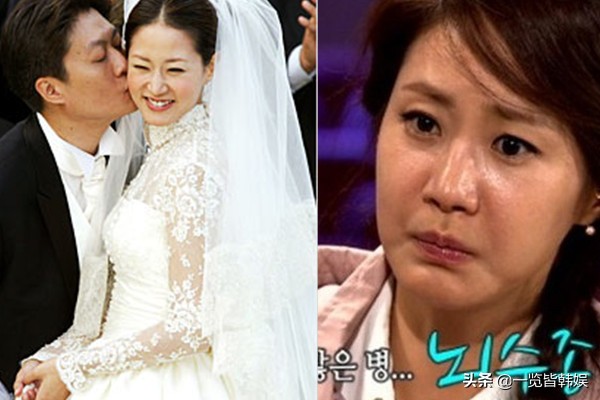 47岁申恩庆图片,47岁申恩庆削骨现状