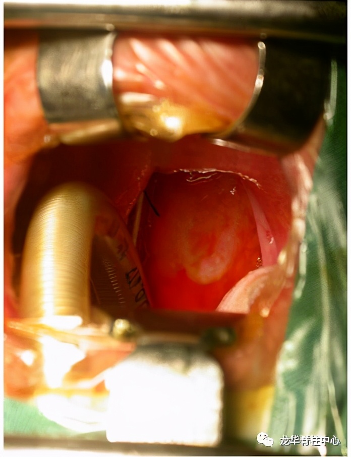 深圳市龙华区人民医院脊柱外科简介