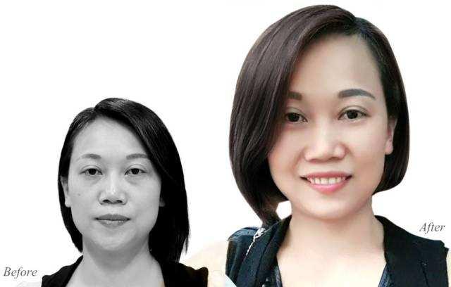 有眼袋怎么办按摩去眼袋,去眼袋眼霜真能去眼袋吗