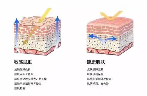 脸部敏感泛红是什么样的,面部皮肤敏感是什么原因造成的