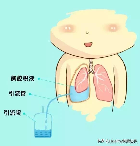 喘不过气的漫画,喘不上气的漫画