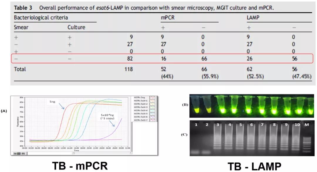 结核诊断方法和防治原则,结核的病原学诊断