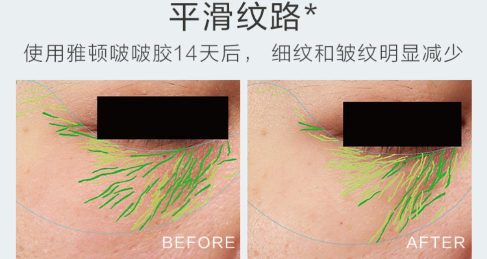 雅顿啵啵胶怎么辨别真假,啵啵胶和雅顿金胶区别