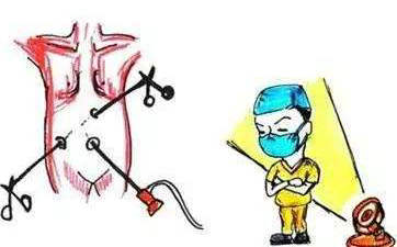 胆囊结石切除后影响寿命,胆囊切除对人寿命影响吗